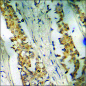 Anti-phospho-Bloom Syndrome (pThr99) antibody produced in rabbit affinity isolated antibody