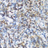 Anti-ARHGEF1 antibody produced in rabbit