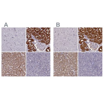 Anti-PAH antibody produced in rabbit Prestige Antibodies&#174; Powered by Atlas Antibodies, affinity isolated antibody, buffered aqueous glycerol solution