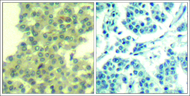 抗-ERBB3 (Ab-1328) 兔抗 affinity isolated antibody