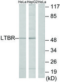 Anti-LTBR antibody produced in rabbit affinity isolated antibody