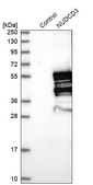 Anti-NUDCD3 antibody produced in rabbit Prestige Antibodies® Powered by Atlas Antibodies, affinity isolated antibody, buffered aqueous glycerol solution, Ab2