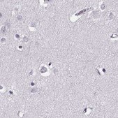 Anti-TCHHL1 antibody produced in rabbit Prestige Antibodies® Powered by Atlas Antibodies, affinity isolated antibody