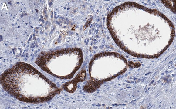 Anti-CXADR/CAR Antibody, clone 1D19 ZooMAb&#174; Rabbit Monoclonal recombinant, expressed in HEK 293 cells