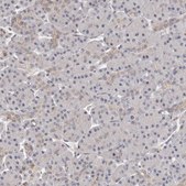 Anti-TRIP13 antibody produced in rabbit Prestige Antibodies® Powered by Atlas Antibodies, affinity isolated antibody, buffered aqueous glycerol solution