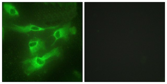 Anti-TNR4 antibody produced in rabbit affinity isolated antibody