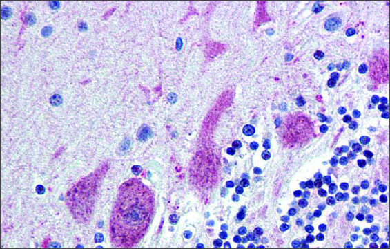 Anti-ST18 antibody produced in rabbit affinity isolated antibody