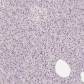 Anti-CASKIN1 antibody produced in rabbit Prestige Antibodies® Powered by Atlas Antibodies, affinity isolated antibody, buffered aqueous glycerol solution