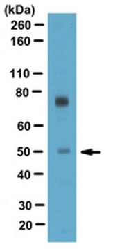 Anti-T-box transcription factor TBX5 Antibody serum, from rabbit