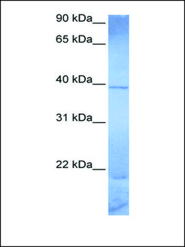 Anti-ZNF121 antibody produced in rabbit affinity isolated antibody