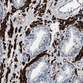 Anti-LANCL2 antibody produced in rabbit Prestige Antibodies® Powered by Atlas Antibodies, affinity isolated antibody, buffered aqueous glycerol solution