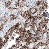 Anti-CLDN3 antibody produced in mouse Prestige Antibodies® Powered by Atlas Antibodies, clone CL13129, purified by using Protein A, buffered aqueous glycerol solution