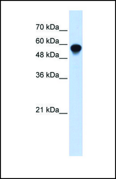 Anti-IRF6 antibody produced in rabbit affinity isolated antibody