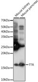 Anti-TTR Antibody, clone 5H4L7, Rabbit Monoclonal