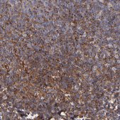 Anti-MVP antibody produced in rabbit affinity isolated antibody, buffered aqueous glycerol solution