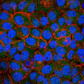 Anti-ICAT Antibody from rabbit, purified by affinity chromatography