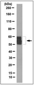 Anti-Tyrosine Hydroxylase Antibody, clone 10F8.2 clone 10F8.2, from mouse