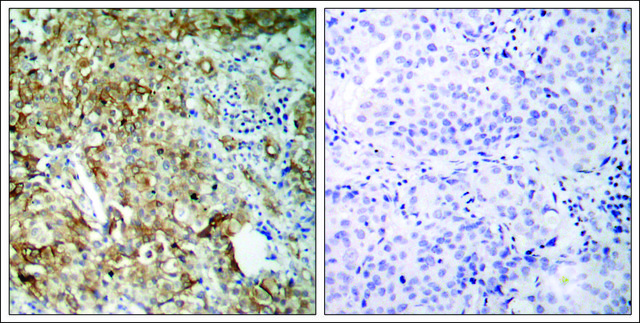 Anti-IGF1R (Ab-1161) antibody produced in rabbit affinity isolated antibody