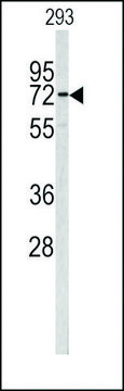 ANTI-CEA (CENTER) antibody produced in rabbit purified immunoglobulin, buffered aqueous solution