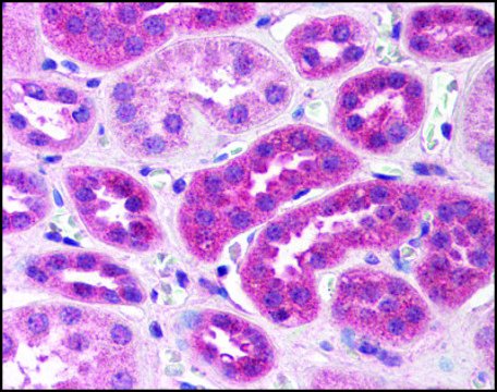 Anti-TANK (AB2) antibody produced in rabbit affinity isolated antibody, buffered aqueous solution