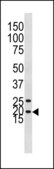 ANTI-LC3 (APG8C) (N-TERM) antibody produced in rabbit IgG fraction of antiserum, buffered aqueous solution
