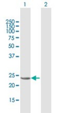 Anti-GSTA1 antibody produced in mouse purified immunoglobulin, buffered aqueous solution