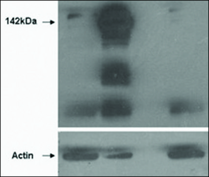 Anti-TNKS (N-terminal) antibody produced in goat affinity isolated antibody, buffered aqueous solution