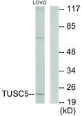 Anti-TUSC5 antibody produced in rabbit affinity isolated antibody