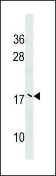 ANTI-UBE2V2 (CENTER) antibody produced in rabbit IgG fraction of antiserum, buffered aqueous solution