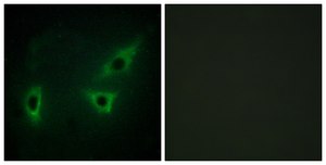 Anti-ATP7B antibody produced in rabbit affinity isolated antibody