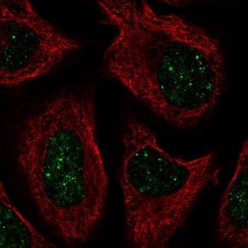 Anti-CNOT7 antibody produced in rabbit Prestige Antibodies&#174; Powered by Atlas Antibodies, affinity isolated antibody