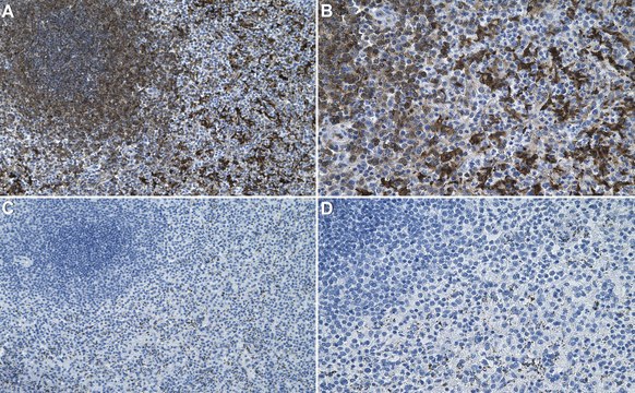 Anti-ERK5 Antibody, clone 2H15 ZooMAb&#174; Rabbit Monoclonal recombinant, expressed in HEK 293 cells