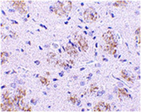 Anti-KLHL1 Antibody from rabbit, purified by affinity chromatography