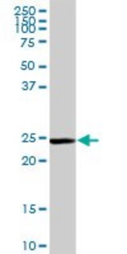 Anti-GSTM5 antibody produced in rabbit purified immunoglobulin, buffered aqueous solution