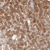 Anti-ALDOB antibody produced in rabbit Prestige Antibodies® Powered by Atlas Antibodies, affinity isolated antibody, buffered aqueous glycerol solution