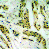 Anti-phospho-TK (pSer13) antibody produced in rabbit affinity isolated antibody
