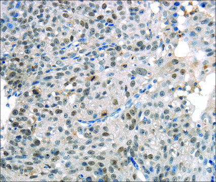 Anti-KDM5C affinity isolated antibody