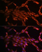 Anti-PAK1 Antibody, clone 6R3M5, Rabbit Monoclonal