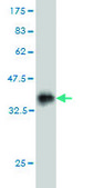 Monoclonal Anti-HOXD11, (N-terminal) antibody produced in mouse clone 6C8, purified immunoglobulin, buffered aqueous solution