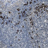 Anti-CLPTM1L antibody produced in rabbit Prestige Antibodies® Powered by Atlas Antibodies, affinity isolated antibody, buffered aqueous glycerol solution