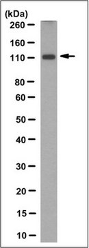 Anti-Mineralocorticoid Receptor Antibody, clone 6G1 clone 6G1, from mouse