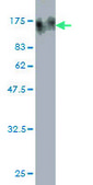 Monoclonal Anti-TOP3B antibody produced in mouse clone 1H4, purified immunoglobulin, buffered aqueous solution