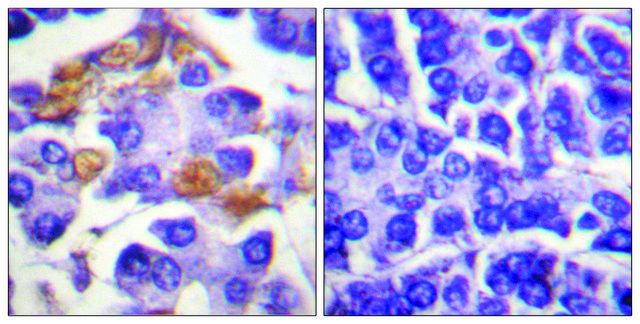 Anti-phospho-C-RAF (pTyr341) antibody produced in rabbit affinity isolated antibody