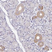 Anti-MT-ND4 antibody produced in rabbit Prestige Antibodies® Powered by Atlas Antibodies, affinity isolated antibody, buffered aqueous glycerol solution