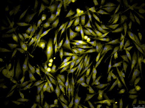 OSUMMER.2 Mouse NRAS-Mutant Melanoma Cell Line