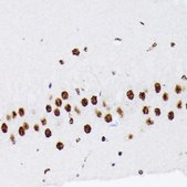 Anti-hnRNP Q/SYNCRIP antibody produced in rabbit