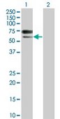 Monoclonal Anti-ACVRL1 antibody produced in mouse clone 7H2, purified immunoglobulin, buffered aqueous solution