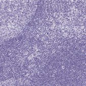 Anti-AVIL antibody produced in rabbit Prestige Antibodies® Powered by Atlas Antibodies, affinity isolated antibody, buffered aqueous glycerol solution