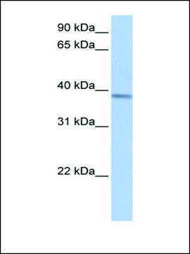 Anti-ACADSB antibody produced in rabbit affinity isolated antibody