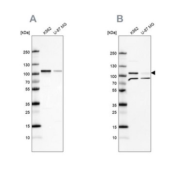 Anti-SRPK1 antibody produced in rabbit Prestige Antibodies&#174; Powered by Atlas Antibodies, affinity isolated antibody, buffered aqueous glycerol solution